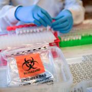 Lab technicians handle suspected COVID-19 samples as they carry out a diagnostic test for coronavirus in the microbiology laboratory inside the Specialist Virology Centre at the University Hospital of Wales in Cardiff..
